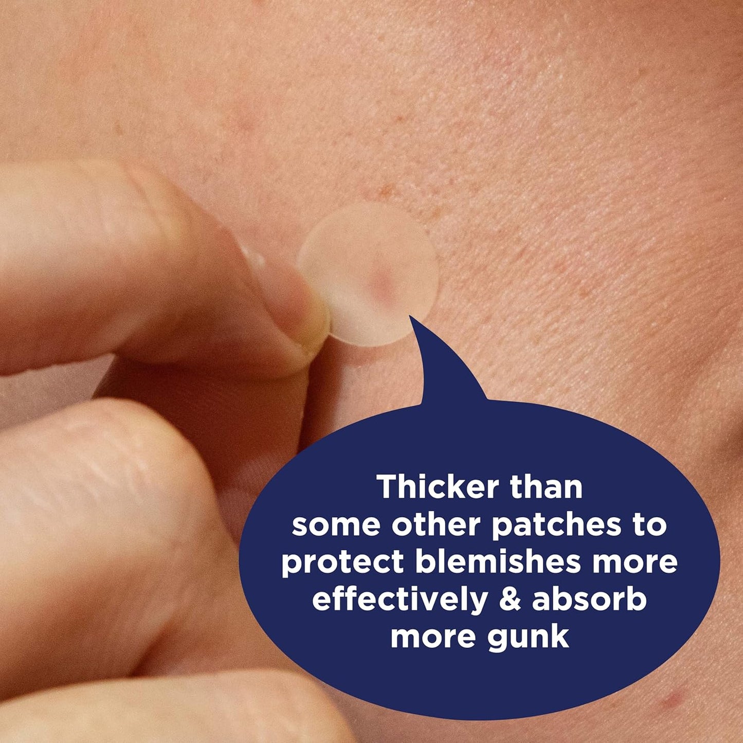 PanOxyl PM Hydrocolloid Patches – Two-Size Minimalist Routine for Clutter-Free Skin